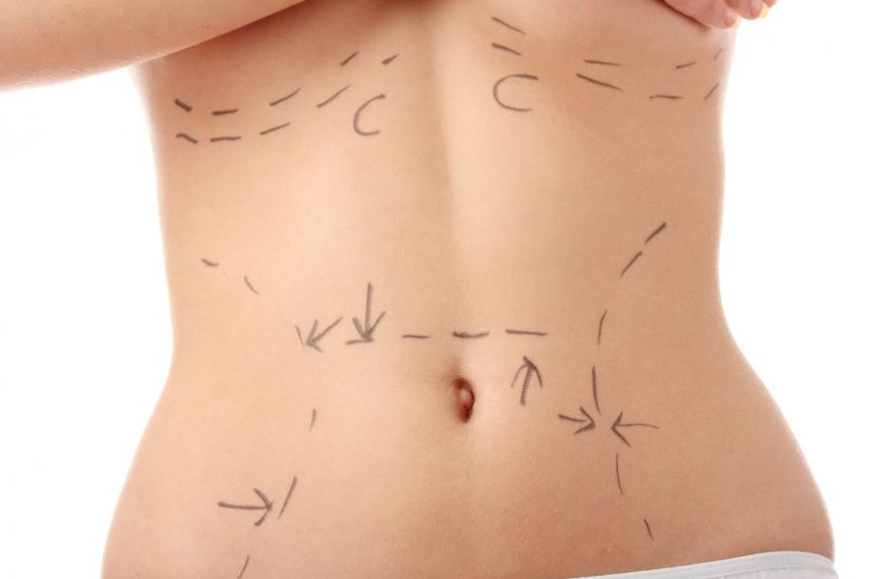 Overcome a Flabby Abdomen