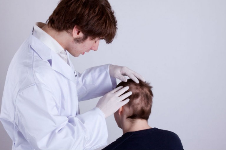 The Advantages of Undergoing Hair Transplant Procedures in Mclean, VA