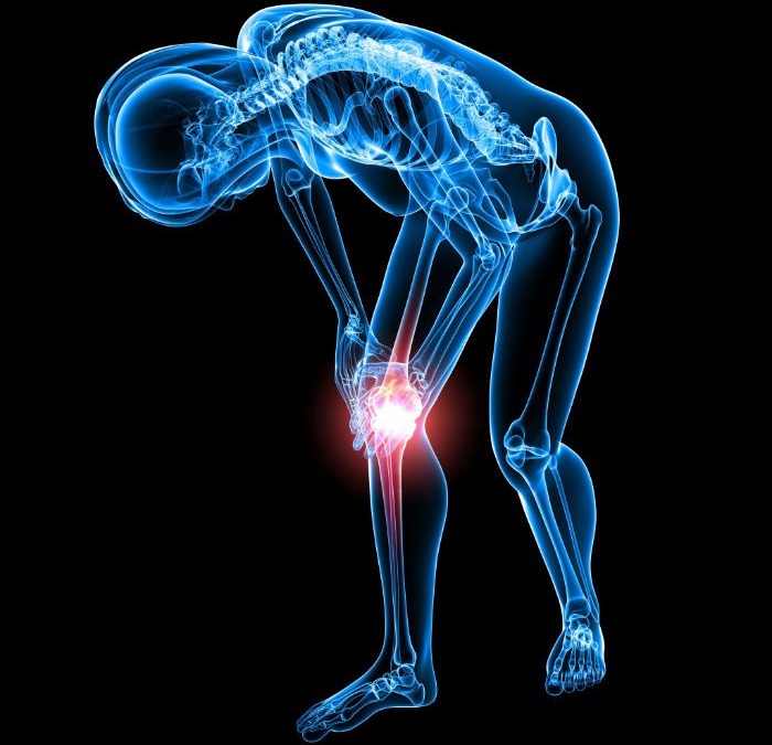 The Right Step – How to Prepare for a Knee Replacement in Midland, TX