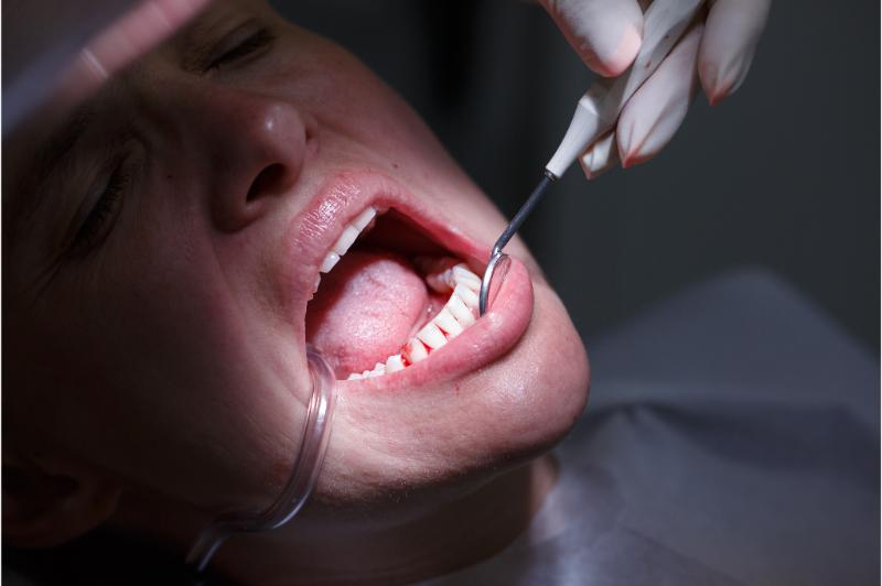 The Ultimate Solution for Tooth Replacement: Everything You Need to Know About Dental Implants in Long Branch, NJ