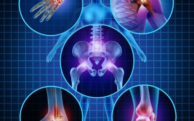 Relieve Pain: Effective Solutions for Slipped Disc Hot in Springs, AR