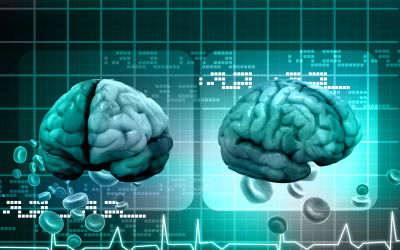 Navigating Multiple Sclerosis Care with Neurologists New Jersey Specialize In
