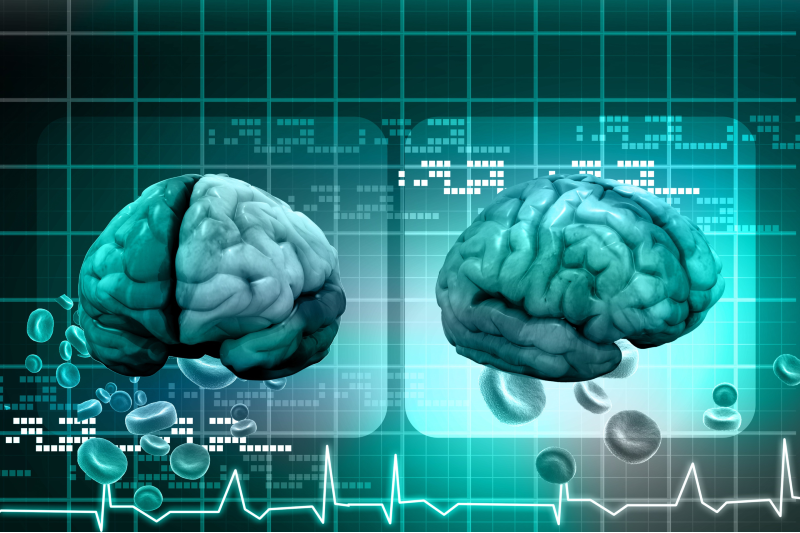Navigating Multiple Sclerosis Care with Neurologists New Jersey Specialize In