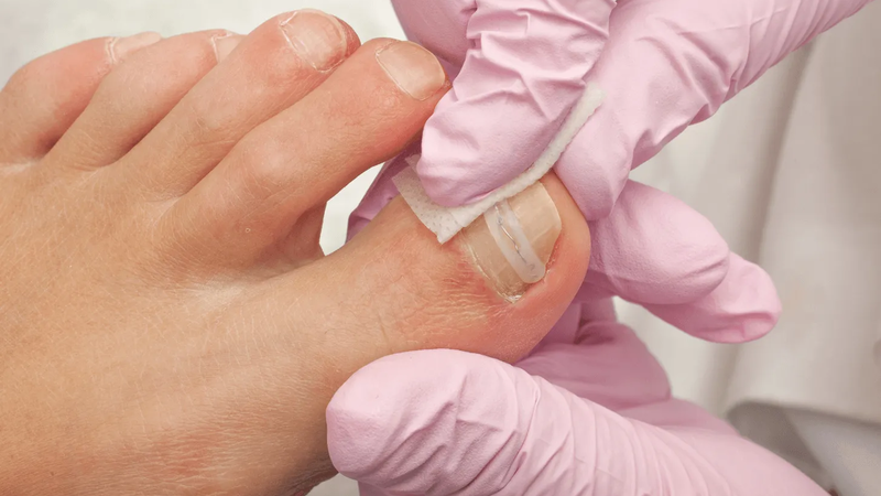 What Makes a Bunion Doctor Different: Qualities to Look for in a Podiatrist