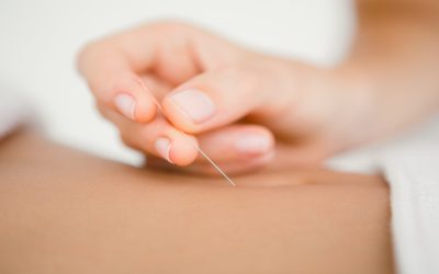 Find Natural Relief with Acupuncture For Anxiety Oakland CA Residents Can Trust
